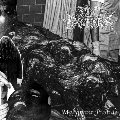 PUS EXCRETOR – Malignant Pustule 7” ***PRE ORDER***