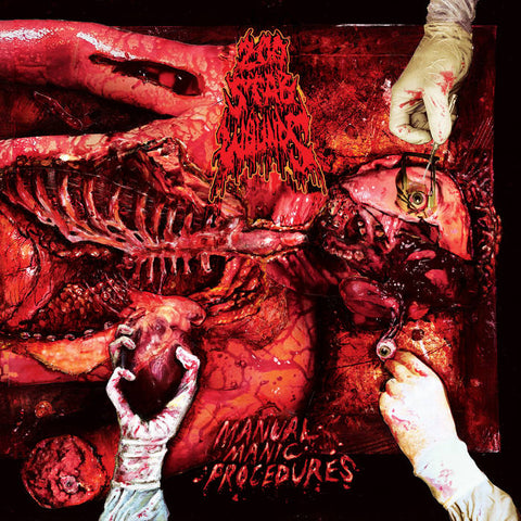 200 Stab Wounds - Manual Manic Procedures LP ***PRE ORDER***
