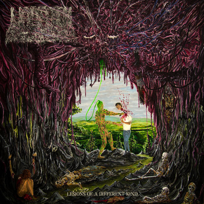 Undeath - Lesions Of A Different Kind LP